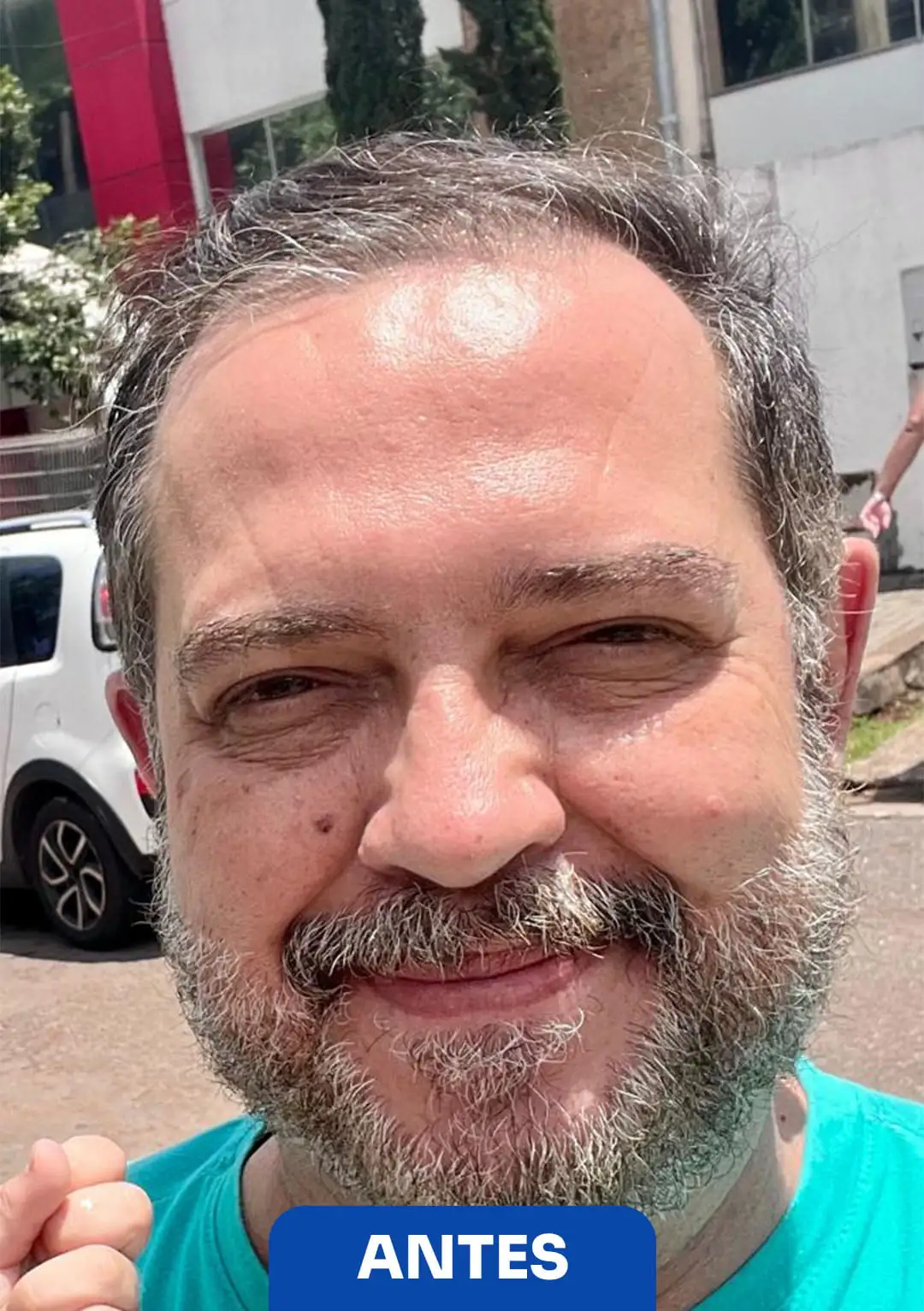 Sem Título-1DEPOIMENTO 1 (ANTES)