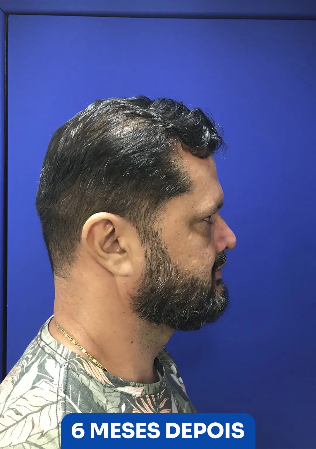 Sem Título-1DEPOIMENTO 2 (ANTES)